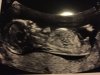 36082D86-B827-4B61-89C0-C860BBBD98C0.jpeg