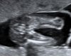 20180403_194744.jpg