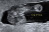 20180403_194817.jpg