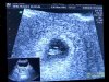 Screenshot_20180409-111414_Photos.jpg