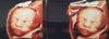 IMG-20180330-WA0001456.jpMMHg.jpg
