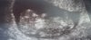 D81A53D7-1055-4F74-9CB5-F0603E0A0F00.jpeg