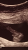 DB0DD43E-6168-4EE4-9861-B8F84DA7E926.png