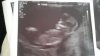 IMG-20180418-WA0019.jpeg