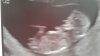 IMG-20180418-WA0015.jpeg