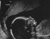 NoahUltrasound_Apr24_2.jpg