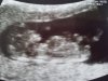 20180424_110937.jpg