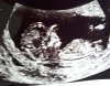 IMG-20180424-WA0006.jpg