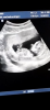 B472717C-1B1C-4888-88CE-CE2C8A63F7F1.png