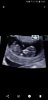 Screenshot_20180430-193934_Photos.jpg