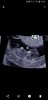 Screenshot_20180430-194006_Photos.jpg