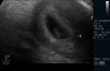 baby van eekelenzw.jpg