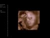 Baby.jpg