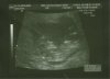echo-21nov'12.jpg