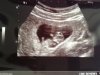 upload_2018-5-4_19-54-20.jpeg