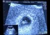 Screenshot_20180504-150827_Photos.jpg