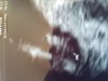 20180515_172456.jpg