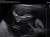 Baby 1 been.jpg