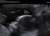 Baby 1 gezicht.jpg