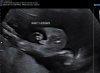 Baby 1 jongen.jpg