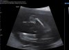 Baby 2 jongen.jpg