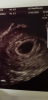 Screenshot_20180521-020643.png
