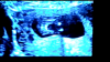 630F4957-EA3F-49C6-BDED-F9D193004EEF.png