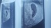 20180514_110859.jpg