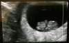 525EB751-BE3E-4867-AA83-F65CAE745E50.jpeg