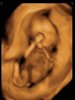 Screenshot_20180605-131235_Photos.jpg
