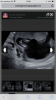 93A1CC1A-E8AB-4F39-98F7-00D2029E92D7.png