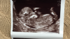 2022D74A-054D-4DE5-8134-5B9607BAEE4A.png