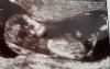 20180615_091211.jpg