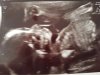 20180615_174810.jpg