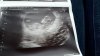 IMG-20180618-WA0012.jpeg
