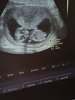 IMG-20180615-WA0010.jpg