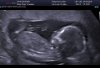 received_1647624062023296.jpeg