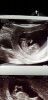 Screenshot_20180626-121941_Gallery.jpg