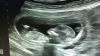 3702248F-AA55-4DAD-9962-87289BF73F0A.png