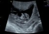 baby Ariana.jpg