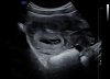 20180630_094158.jpg
