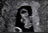 20180704_113636.jpg