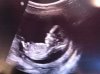 foto (12w6d).jpg