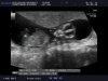 baby wiltvank (9).jpg