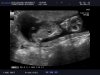 baby wiltvank (20).jpg