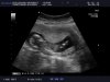 baby wiltvank (2).jpg