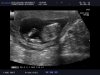 baby wiltvank (22).jpg