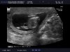 baby wiltvank (23).jpg