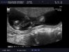 baby wiltvank (28).jpg