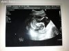 16.5 weken baby1.jpg